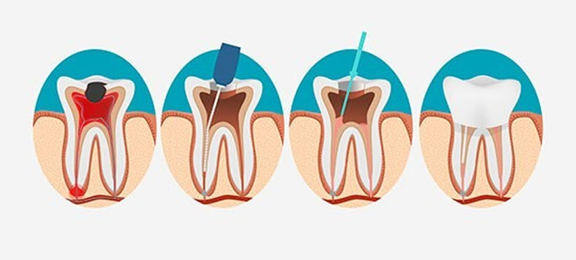 Endodontia